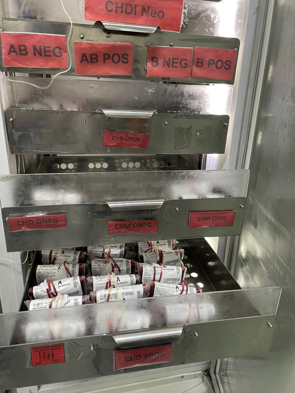 Santa Casa BH faz alerta para baixo estoque de sangue no fim de ano e convida população à doação  1